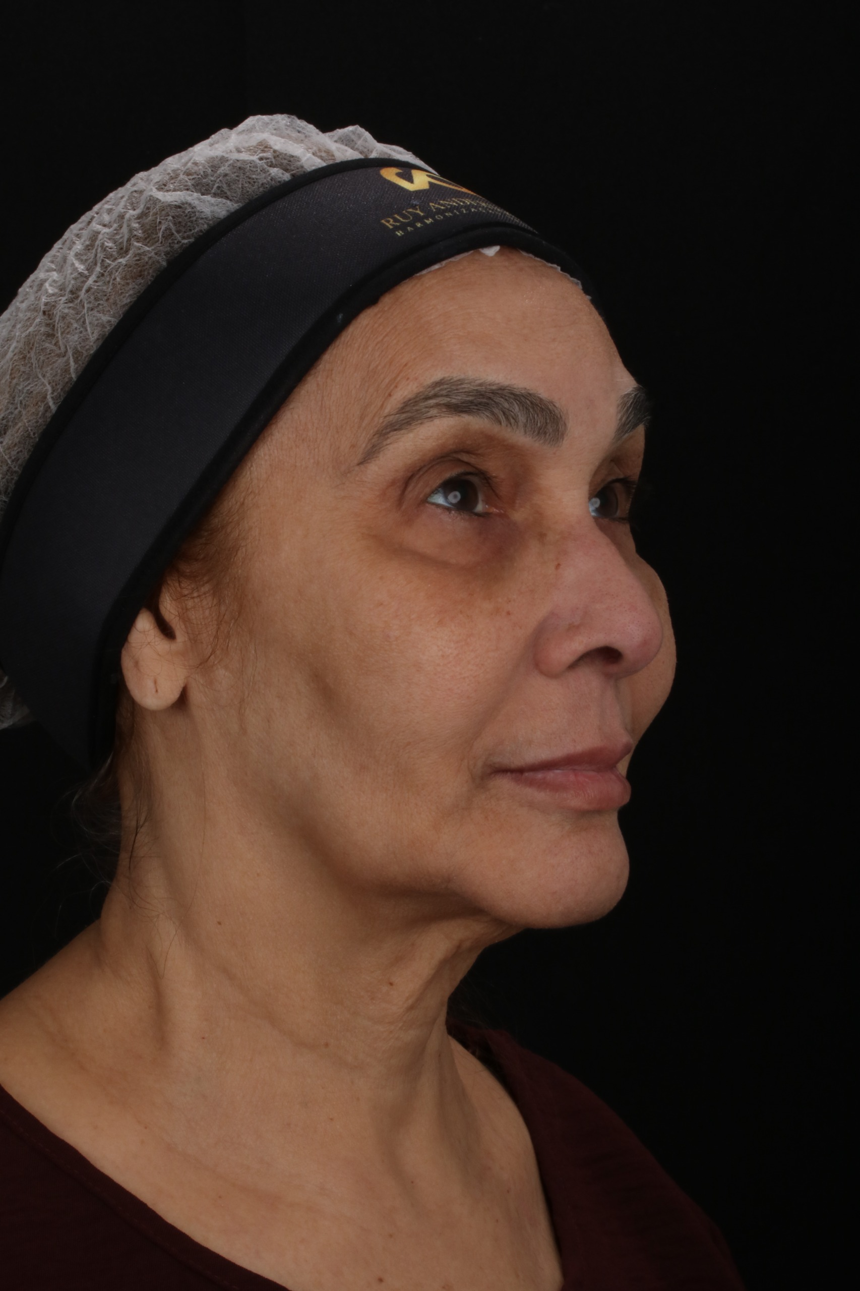 Angela - Antes