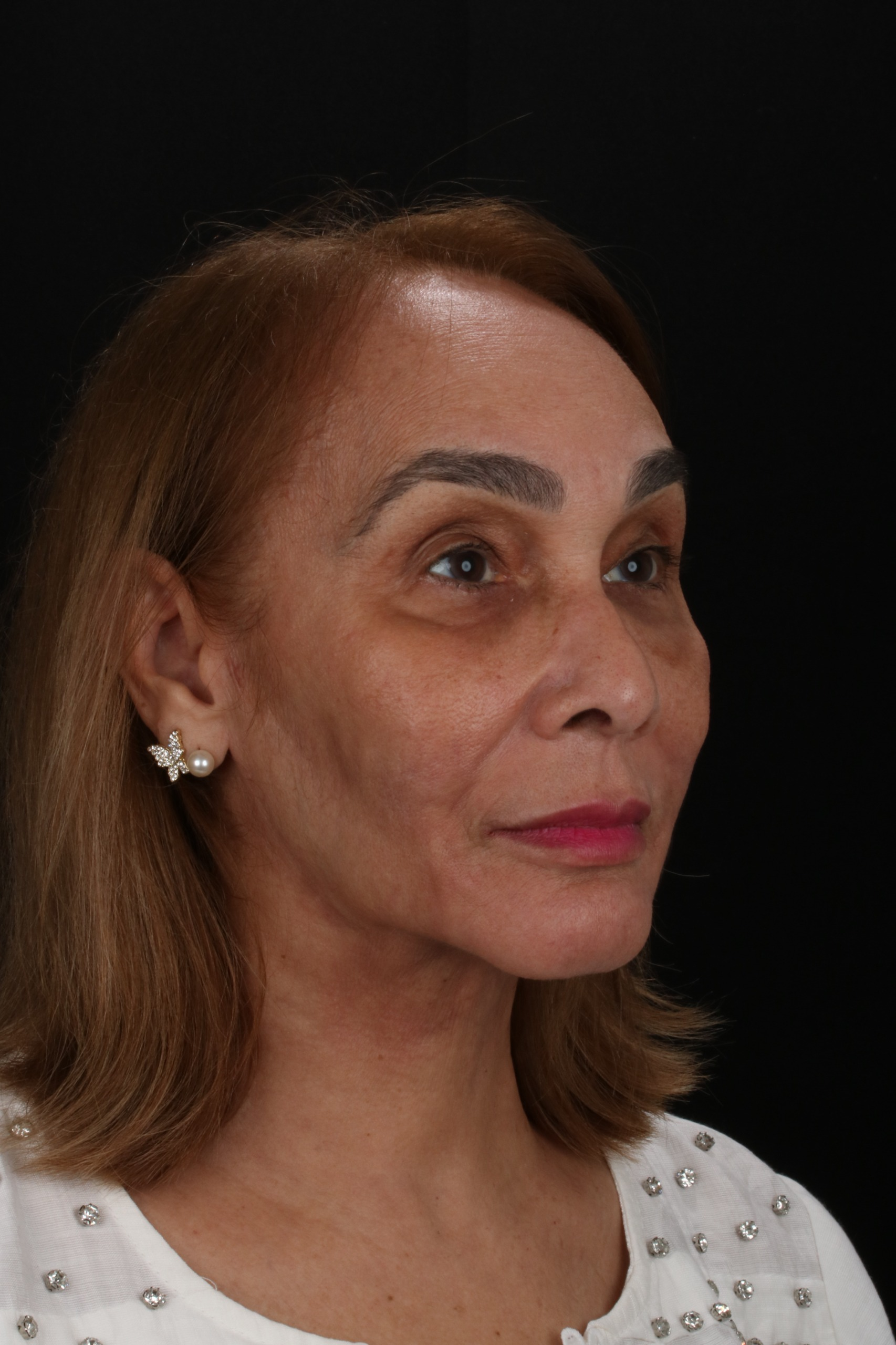 Angela - Depois