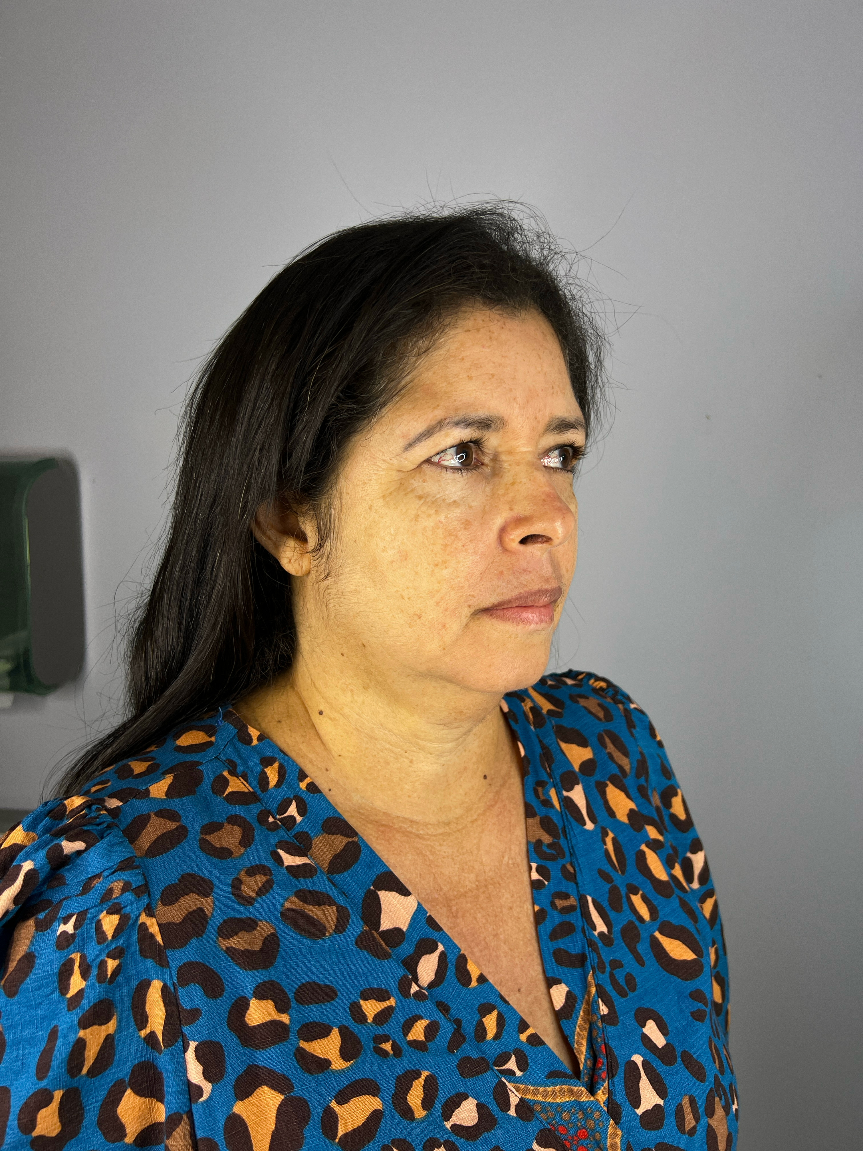 Fabiane - Antes