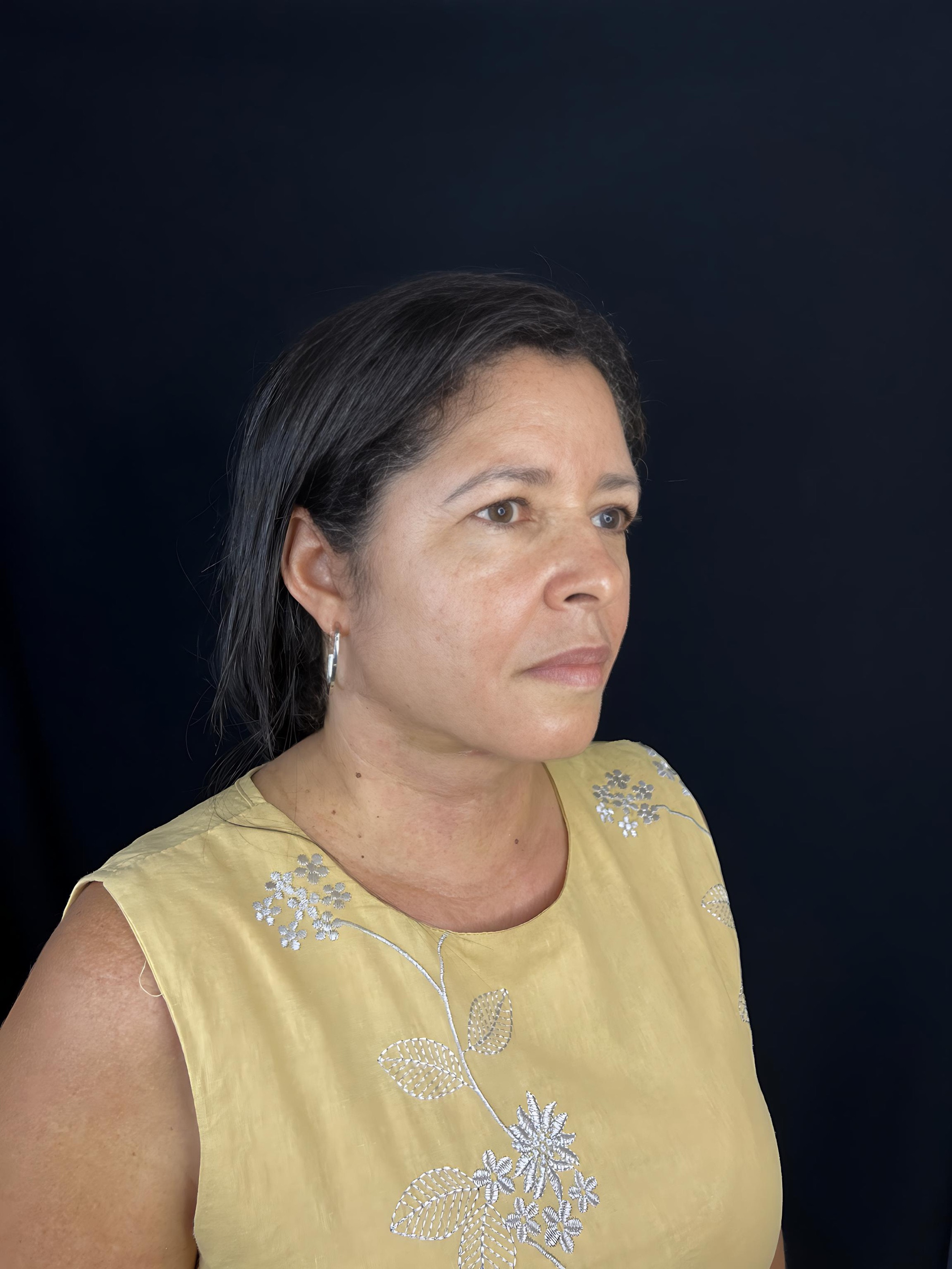 Fabiane - Depois