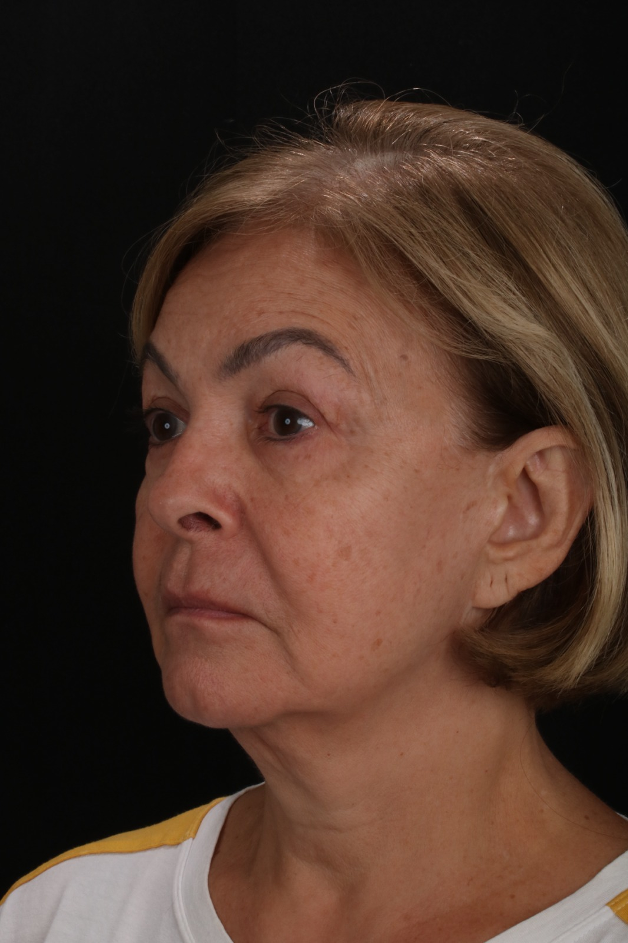 Rita - Antes